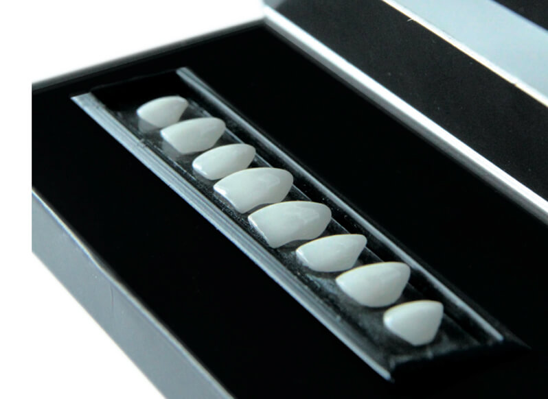 Facette dentaire Paris