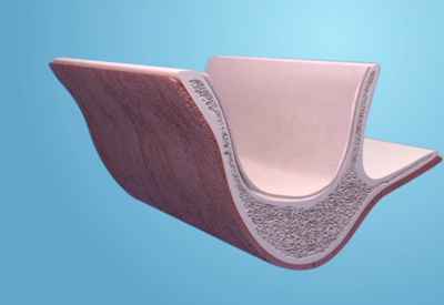 L analyse pre-implantaire